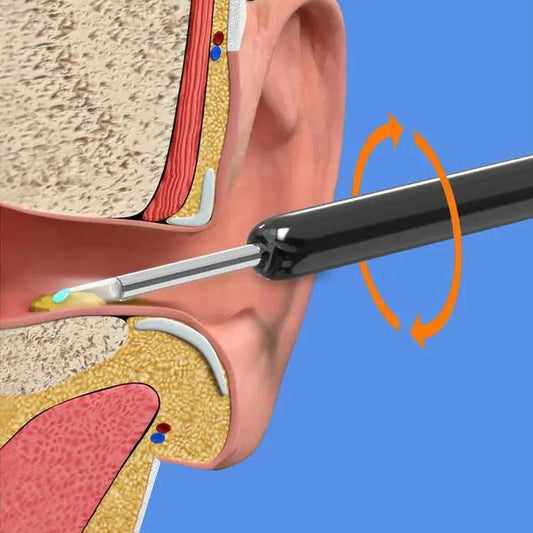 Otoscopio Digital Inalámbrico NE3 para Limpieza Visual de Oídos