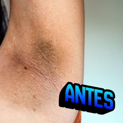 Jabón Blanqueador y Removedor de Manchas Oscuras para Zonas Sensibles